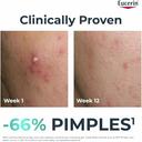 Eucerin Dermo Purifyer Triple Effect Serum For Post Acne Marks 40ml