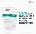 Eucerin Dermopure Correcting Cleanser 150ml