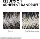 Vichy Dercos Anti-Dandruff DS Shampoo for Normal to Oily Hair 200ml