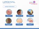 Lipohyal Wound Care Spray 125ml