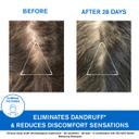 Uriage DS Hair Anti Dandruff Treatment Shampoo 200ml